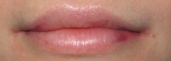 Lipofiling