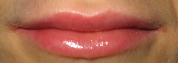 Lipofiling
