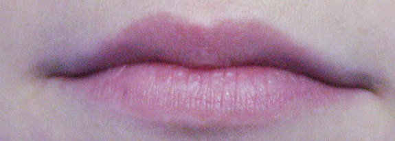 Lipofiling