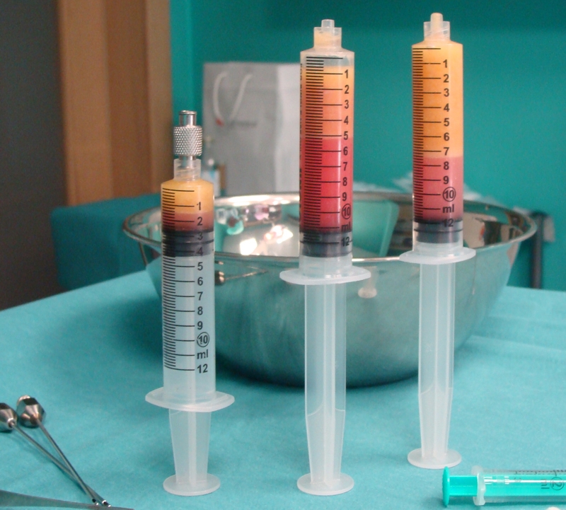 Lipofiling