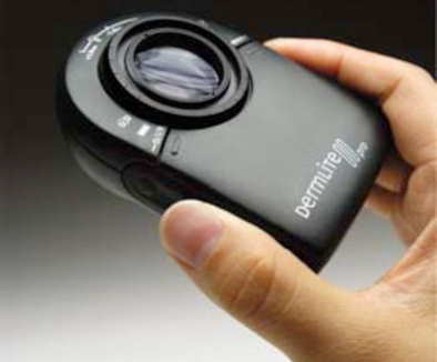 Dermatoscopy